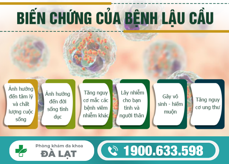 Hình ảnh minh họa